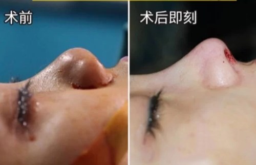 南京最熱門的環(huán)形精雕吸脂醫(yī)療美容醫(yī)院綜合推薦！2023年排行前十名大揭曉！