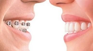 2023年鄭州高性?xún)r(jià)比的秒雕祛淚溝醫(yī)美院排名揭曉！整形美容醫(yī)院評(píng)選名單發(fā)布