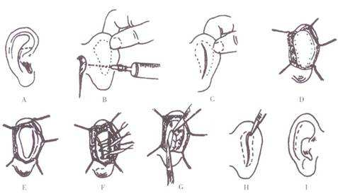 2023杭州細(xì)胞填充面部整形美容醫(yī)院排行榜公布！尋找最可靠的選擇