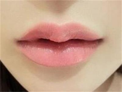 滕州哪家整形醫(yī)院祛痘印效果好？2023年前10名的微雕整容醫(yī)院找到了！