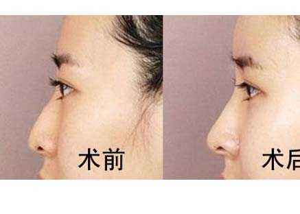 六安市受歡迎的雙眼皮整形美容醫(yī)院排行榜出爐！2023最值得信賴的明眸翹睫醫(yī)療機(jī)構(gòu)盤點(diǎn)！