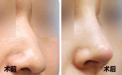 2023西寧市10家聲譽卓越的整形美容醫(yī)院，注射美白針效果非好好！