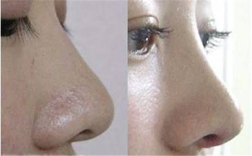 2023年北京填充川字紋凹陷醫(yī)療美容院排名前10的優(yōu)秀口碑醫(yī)院推薦，快速記錄！