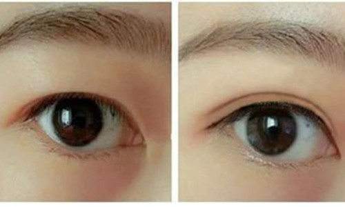 黑龍江激光祛斑祛痘醫(yī)生