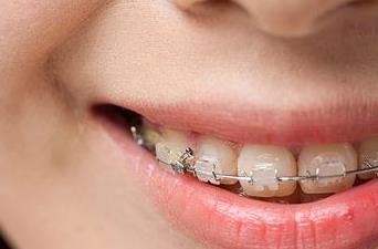 鄭州面部藝術(shù)微雕醫(yī)生