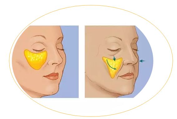 滄州哪家醫(yī)院治痘痘靠譜？推薦2023年口碑前十的權(quán)威整形美容醫(yī)院！