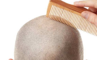 馬鞍山有哪些木偶紋消除醫(yī)院值得推薦？2023年10家木偶紋消除醫(yī)療機構(gòu)盤點