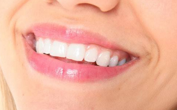 深圳醫(yī)院排行榜！2023年最值得信賴的外切法祛眼袋醫(yī)療美容名單揭曉！