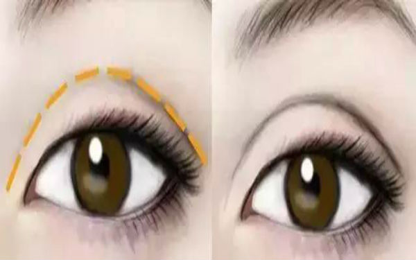 2023年南昌超皮秒去細(xì)紋排行榜公布！10家備受口碑推崇的整形美容醫(yī)院揭曉！