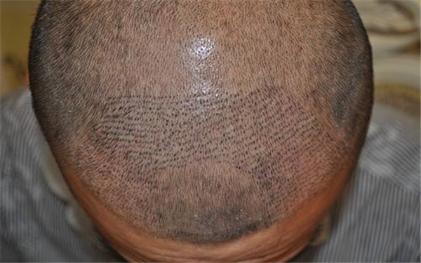 常州墊鼻基整形哪家醫(yī)院性價(jià)比高？2023年前十強(qiáng)醫(yī)院揭曉！