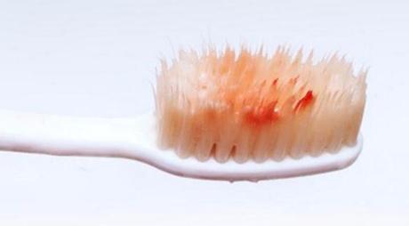 蘇州去祛除太田痣醫(yī)生