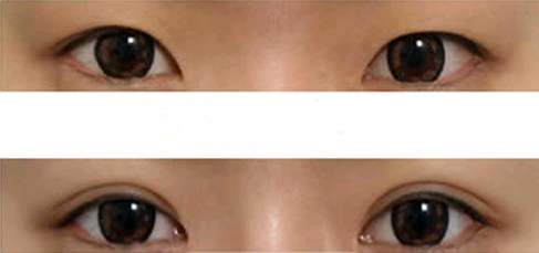 佛山口周紋有哪些醫(yī)院可以進行活細(xì)胞治療？2023排名前10的專業(yè)機構(gòu)精選！