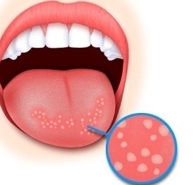 蘇州做大腿抽脂醫(yī)生