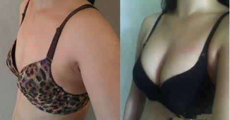 2023年武漢微雕點陣去疤痕十大口碑權(quán)威整形醫(yī)院揭秘！