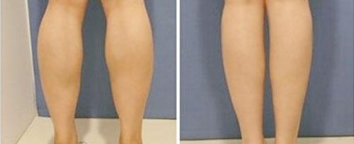 鄭州這家醫(yī)療整形院治療痘坑效果不錯(cuò)，值得推薦！2023最新排名TOP10出爐！