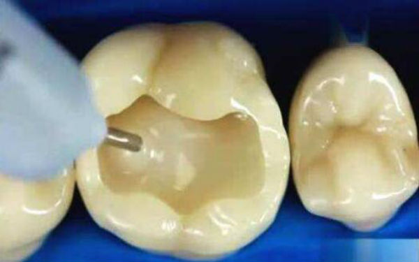 廣州哪家醫(yī)院針雕祛除眉間紋效果比較好？2023年排名前十名單揭曉！