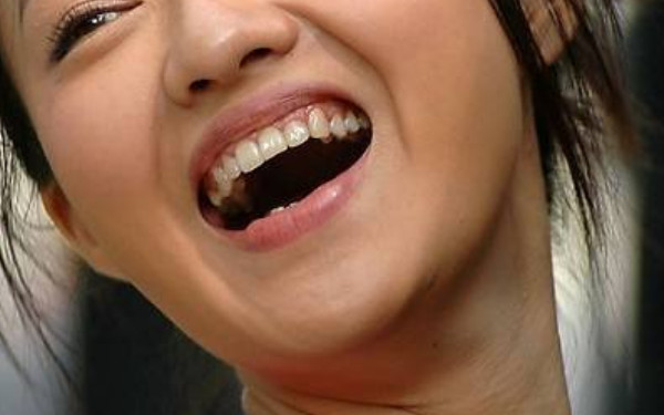 2023年達(dá)州黃金微針祛除口周紋的獨(dú)家推薦列表！榜單前10強(qiáng)達(dá)州美容整形醫(yī)院揭秘！