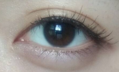 2023年強勢來襲！德州整形醫(yī)院推出全臉去痣首選，前十強榮耀問世！