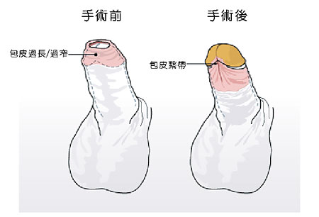 2023年成都精雕祛面部皺紋排名前十的整形醫(yī)院推薦