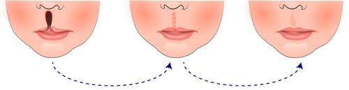 青島哪家醫(yī)院的微雕去眉間紋效果好？2023年排名前十實力醫(yī)院推薦！