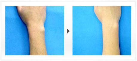 長沙微創(chuàng)印第安紋整形醫(yī)院2023年評價TOP10強名單發(fā)布