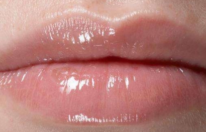 蘭州比較靠譜的去口周紋整形醫(yī)院是哪家？2023年蘭州去除口角紋綜合排名揭曉，這幾家口周紋醫(yī)療整形醫(yī)院實力