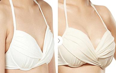 重慶冷凍法去黃褐斑醫(yī)生