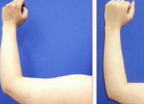 綿陽鼻背寬整形醫(yī)院推薦！2023綿陽鼻背寬美容醫(yī)院排行榜出爐，網(wǎng)友大贊這些！