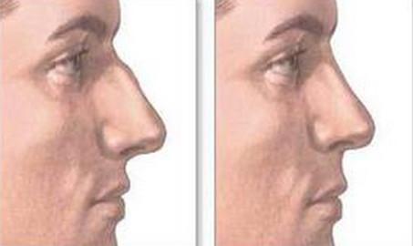 2023年合肥治療筒狀乳房畸形首選的專業(yè)整形醫(yī)院排行榜TOP10強(qiáng)推薦！