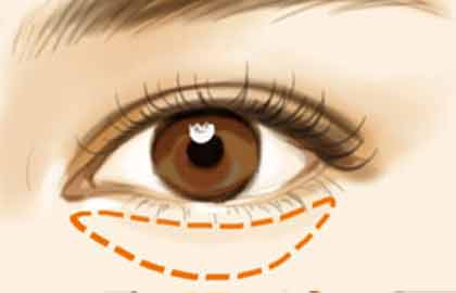 2023沈陽重瞼整形美容醫(yī)院哪家好？推薦10家技術(shù)過硬的醫(yī)療整形機(jī)構(gòu)！