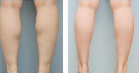 重慶馥蘭朵雙眼皮整形醫(yī)院排行榜2023年前十名單公布，專業(yè)技術(shù)與優(yōu)勢盡現(xiàn)！