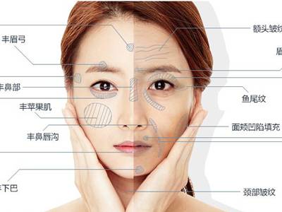 廣州臉部打溶脂針排名前10的美容醫(yī)院口碑大揭秘！2023年很受好評的整形醫(yī)院技術(shù)盤點(diǎn)！