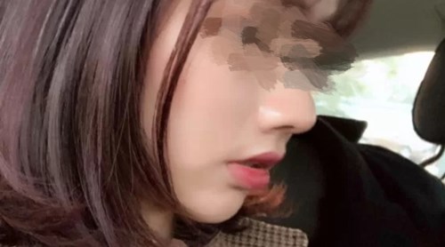 貴陽有哪些專業(yè)的磨皮去痘印醫(yī)院？2023年TOP10推薦實(shí)力醫(yī)院揭曉