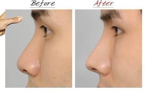 2023深圳E光腿部脫毛整形美容醫(yī)院推薦榜單前十強(qiáng)揭曉！這些醫(yī)院名氣大、口碑好，一定要了解！