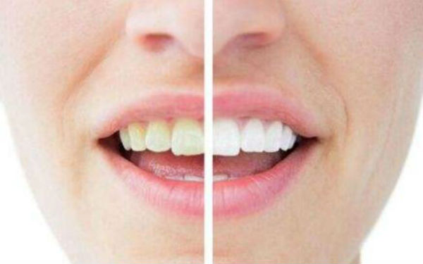 深圳豐太陽穴整形醫(yī)院口碑非好好！2023年十佳面部注射豐太陽穴醫(yī)院排名出爐