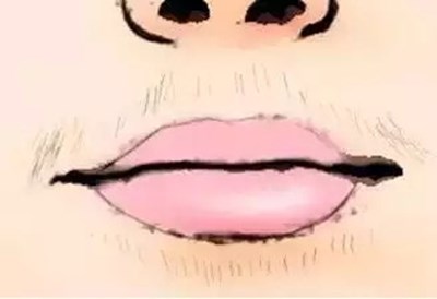 泰州鼻唇溝醫(yī)療美容醫(yī)院口碑好的推薦！2023泰州肉毒素打鼻唇溝top10強勢醫(yī)院震撼登場！