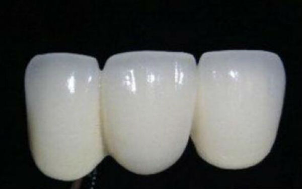 徐州豐太陽穴整形醫(yī)院推薦！2023非常受歡迎的膨體填豐太陽穴醫(yī)療機(jī)構(gòu)介紹！