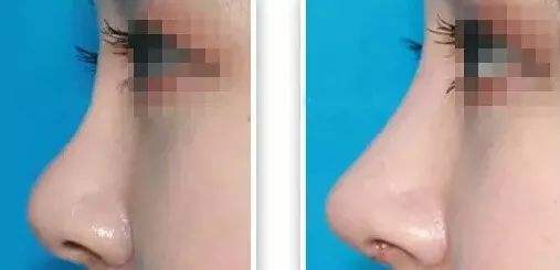 2023寧波頭部皺紋祛除醫(yī)院口碑排行榜top10公開總結(jié)！