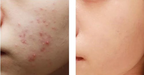 【重慶法令紋填充正規(guī)整形醫(yī)院】-2023年前十位權(quán)威醫(yī)生傾情推薦！