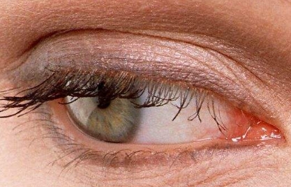 2023年口碑爆棚！蘇州肉毒素整形美容醫(yī)院排名前10，暢銷！