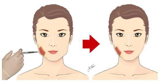 成都隆鼻整形醫(yī)院TOP10名單公布，2023年最受贊譽的美容醫(yī)院詳細概況！