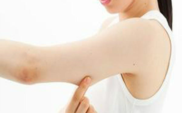 2023年黑龍江去眼角紋哪家醫(yī)院好？排行榜前10強整形美容醫(yī)院推薦！