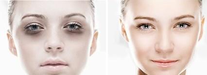 北京哪些醫(yī)院的激光去黑頭效果好？2023年排名前10的強整形醫(yī)院推薦！