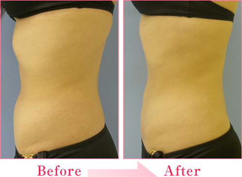 2023年，桂林哪家醫(yī)療整形醫(yī)院排名前十的專業(yè)眼紋去除法整形醫(yī)院