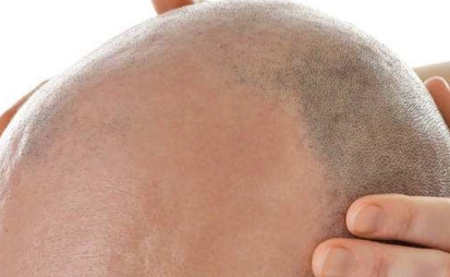 寧波市有哪些口碑比較好的整形美容醫(yī)院？2023年推薦的綜合鼻整形前十名！