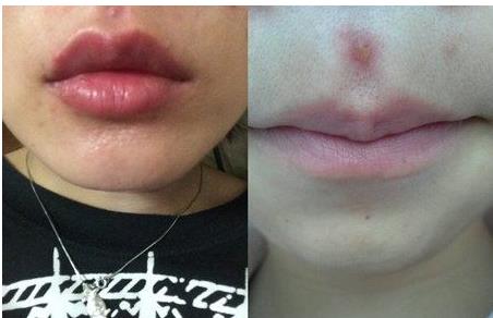 2023青島哪些醫(yī)院口碑好，提供專業(yè)的提拉魚尾紋醫(yī)療美容服務(wù)？青島魚尾紋醫(yī)院TOP10強(qiáng)機(jī)構(gòu)推薦