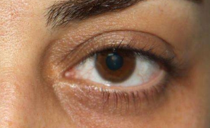 唐山哪家專業(yè)整形醫(yī)院在韓式微創(chuàng)雙眼皮恢復(fù)方面經(jīng)驗(yàn)豐富？2023年唐山醫(yī)療整形院雙眼皮恢復(fù)排名前十可信賴嗎