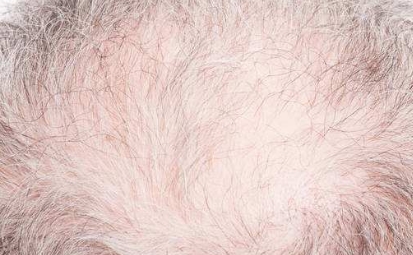 2023成都領先的隱私光電抗衰整容醫(yī)院排名前10公布！