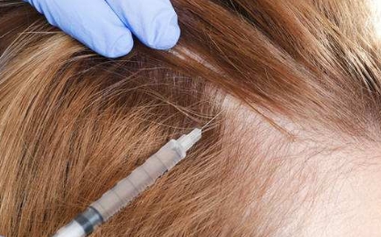 2023年舟山哪家整形醫(yī)院的玻尿酸墊鼻效果？整形醫(yī)院推出了前10名的紅榜！