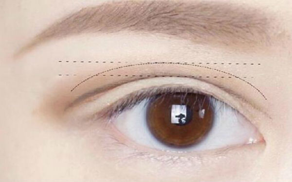 2023西安黃褐斑祛除醫(yī)院排行榜出爐！這十所醫(yī)療整形醫(yī)院備受好評！